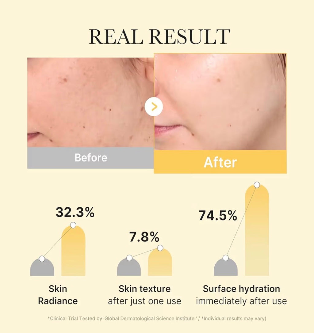 Medicube Kojic Acid Turmeric Brightening Gel Mask - Mascarilla Iluminadora y Antimanchas 28g