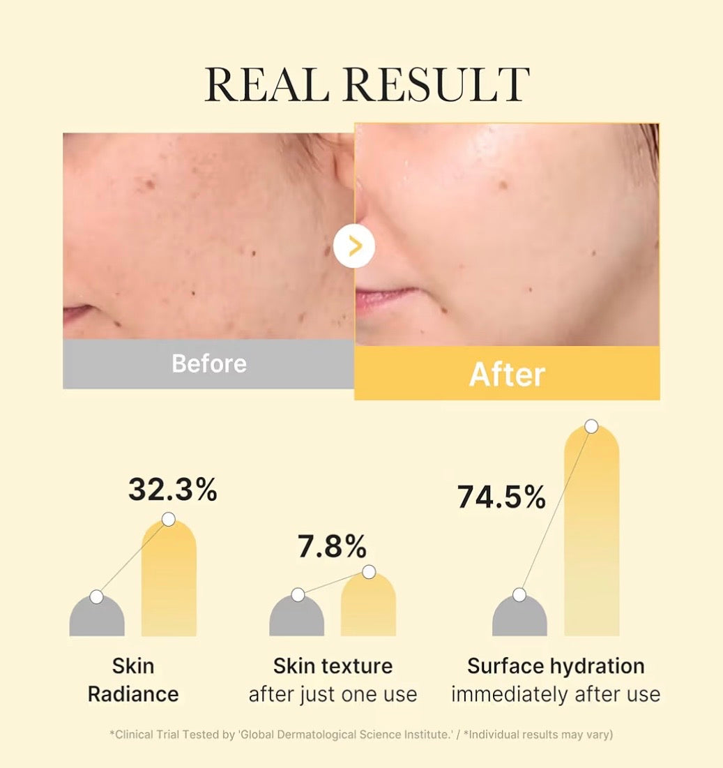 Medicube Kojic Acid Turmeric Brightening Gel Mask - Mascarilla Iluminadora y Antimanchas 28g